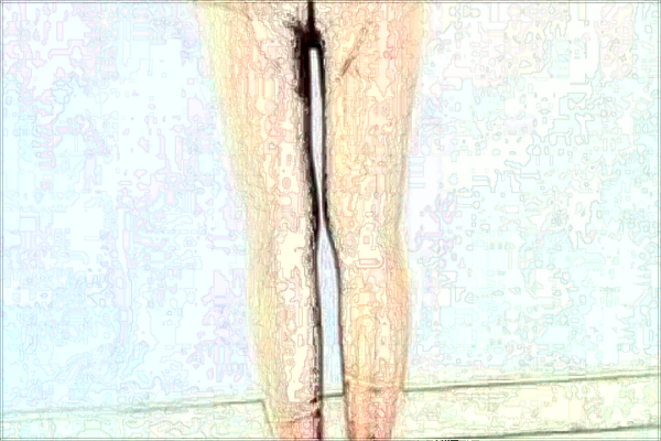 南京市中醫(yī)院激光脫毛哪位醫(yī)生做的好_收費貴不貴