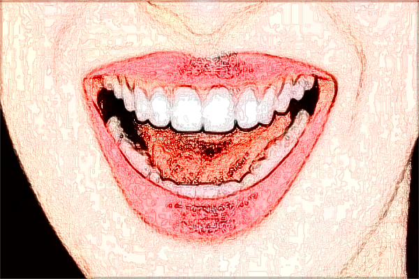 2024淮北市人民醫(yī)院口腔科專(zhuān)家名單介紹【種植牙案例】