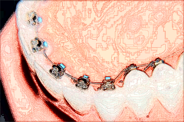 成都華西醫(yī)院口腔科怎么樣_附醫(yī)生名單簡(jiǎn)介