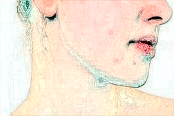 贛南醫(yī)學院第一附屬醫(yī)院光子嫩膚多少錢2024?光子嫩膚好嗎