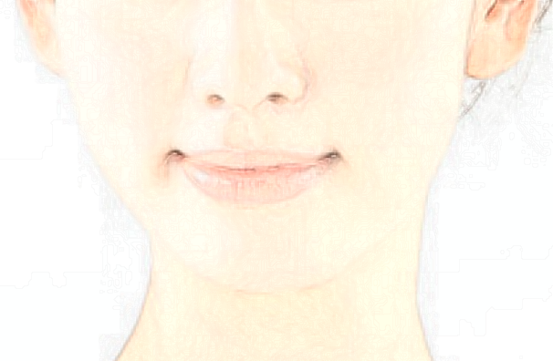 北京大學(xué)第一醫(yī)院玻尿酸做的好嗎_哪位醫(yī)生做的比較好