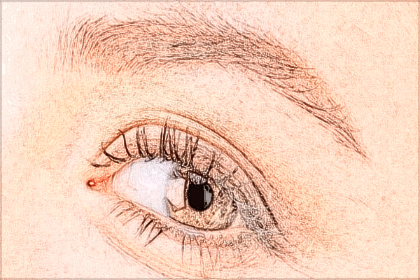 北京大學(xué)第一醫(yī)院激光點(diǎn)痣做的好嗎_哪位醫(yī)生做的比較好