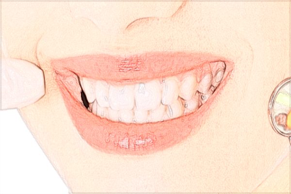 2024北京大學第一醫(yī)院口腔科焦洋醫(yī)生簡介_附案例