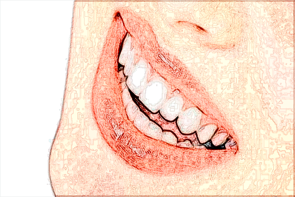 北大口腔醫(yī)院前牙修復(fù)價(jià)目表(價(jià)格表)怎么樣