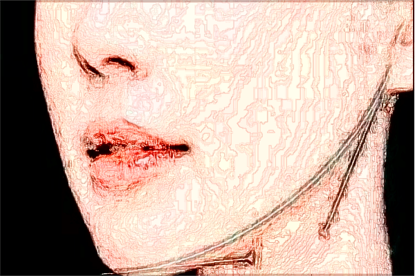 2024上海曙光醫(yī)院去胎記怎么樣_技術(shù)好的醫(yī)生有哪些