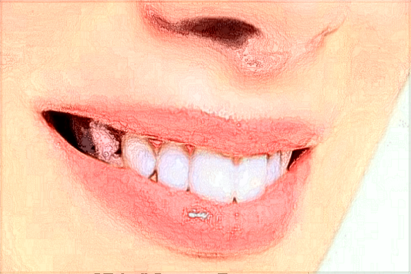 廈門市第一醫(yī)院牙科專家?廈門市第一醫(yī)院牙科收費標(biāo)準(zhǔn)