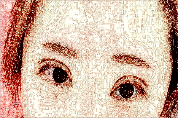 2024上海曙光醫(yī)院去眼袋怎么樣_技術(shù)好的醫(yī)生有哪些