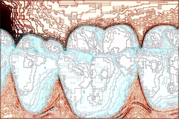 河北省口腔醫(yī)院隱形矯正價格表_做的怎么樣