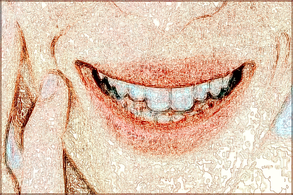 河北省口腔醫(yī)院烤瓷牙多少錢_烤瓷牙和全瓷牙的區(qū)別哪個(gè)好