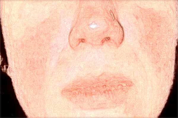 河科大二附院熱瑪吉做的好嗎?熱瑪吉內(nèi)部?jī)r(jià)格2024