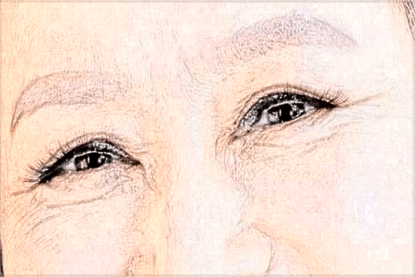 2024河科大二附院光子嫩膚價(jià)格表(價(jià)目表)怎么樣?