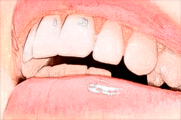 威海市立二院牙齒矯正怎么樣?2024牙齒矯正多少錢?