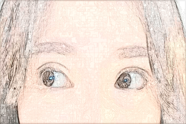 六安市人民醫(yī)院激光祛斑是怎么收費(fèi)的【激光祛斑案例】