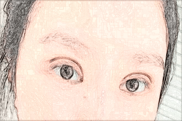 2024四川華西醫(yī)院熱瑪吉價目表(價格表)怎么樣