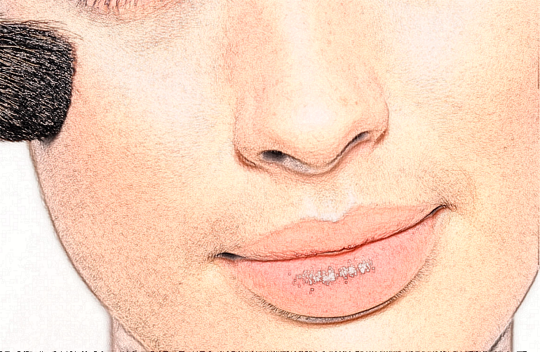 寧波市第一醫(yī)院祛斑價目表(價格表)怎么樣