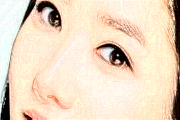 北京大學人民醫(yī)院激光祛斑怎么樣_激光祛斑的危害與效果