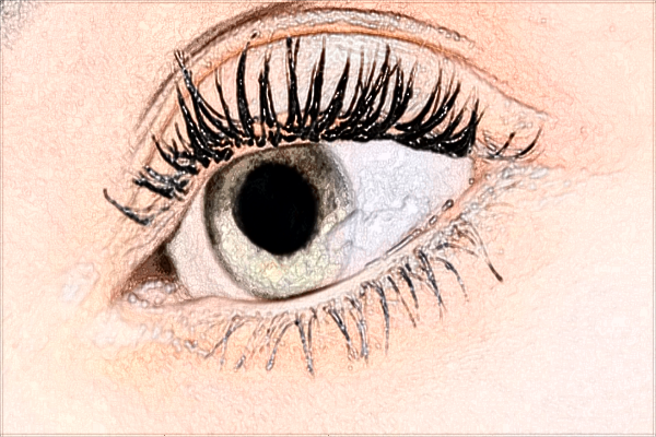 河科大二附院去眼袋技術(shù)怎么樣?2024去眼袋手術(shù)價(jià)格