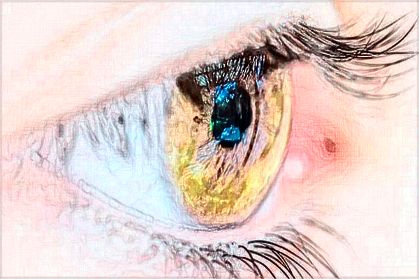 河科大二附院割雙眼皮怎么樣?割雙眼皮新整形價(jià)格2024