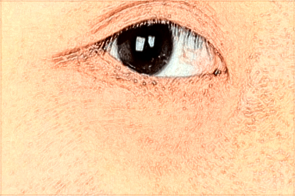 河科大二附院做怎么樣?2024手術(shù)價(jià)格曝光