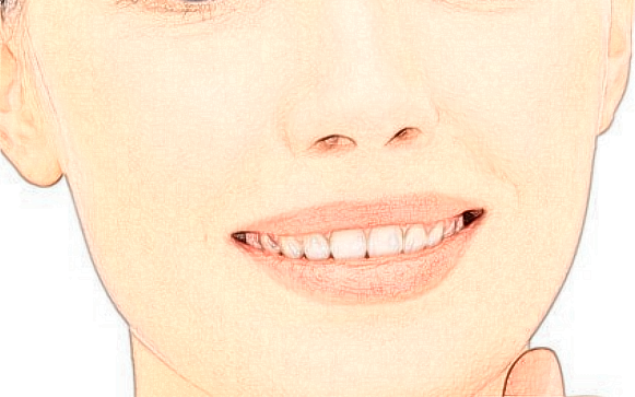 2024上海同濟(jì)醫(yī)院激光脫毛價(jià)格多少【激光脫毛案例】