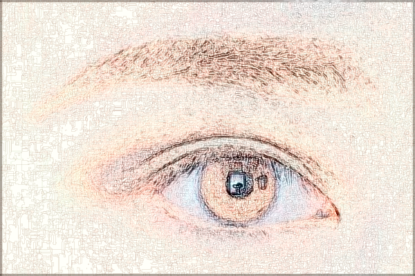 2024上海同濟醫(yī)院祛疤案例_做的怎么樣