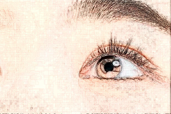 2024浙江省中醫(yī)院割雙眼皮價目表(價格表)怎么樣