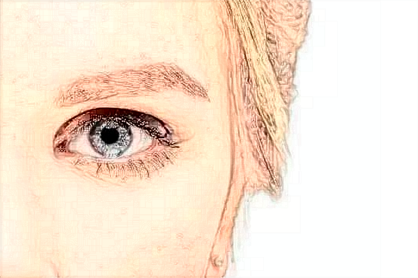 2024浙江省中醫(yī)院做眼袋醫(yī)生技術(shù)怎么樣【做眼袋案例】