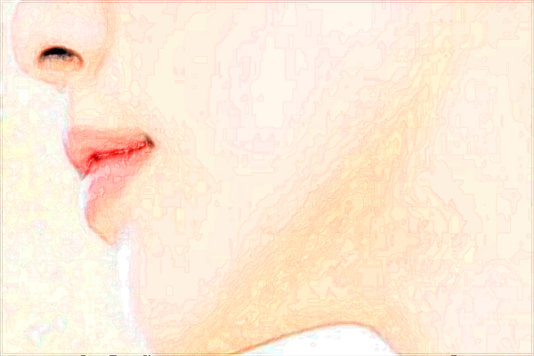 成都華西醫(yī)院去眼袋怎么樣【去眼袋案例】