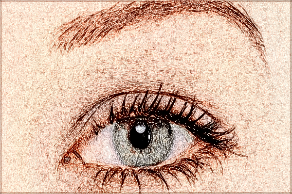 2024寧波李惠利醫(yī)院割眼袋怎么樣_案例+價(jià)格