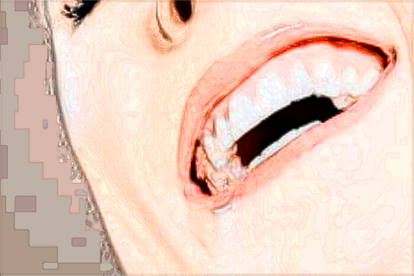 北大口腔醫(yī)院補(bǔ)牙的費(fèi)用是多少_哪個醫(yī)生做的好