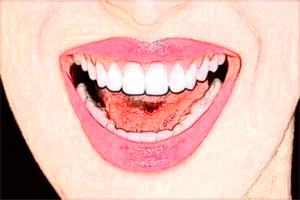 北大口腔醫(yī)院全麻補(bǔ)牙怎么樣_全麻補(bǔ)牙—次性能完成嗎