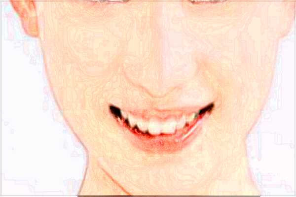 2024河北省中醫(yī)院祛雀斑價(jià)目表(價(jià)格表)公布_怎么樣