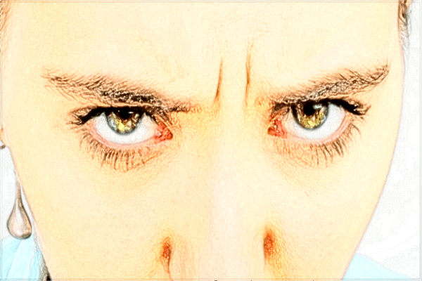 2024西安二院鼻骨矯正價格?鼻骨矯正手術(shù)有后遺癥嗎