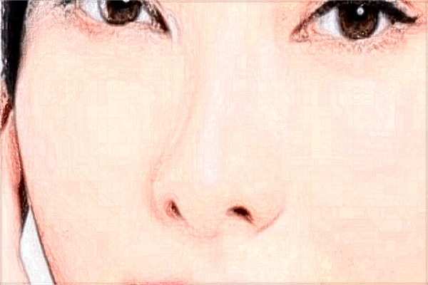 2024西安二院除皺多少錢?拉皮除皺多少錢?