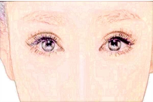 2024北大醫(yī)院去眼袋怎樣_哪個醫(yī)生做得好