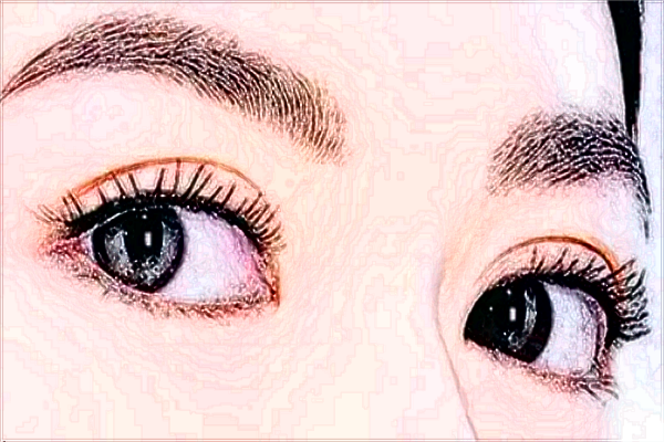 2024北大醫(yī)院去眼袋怎樣_哪個醫(yī)生做得好