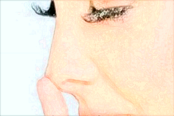 2024廣州華美鼻子哪個醫(yī)生做的好【做鼻子案例】