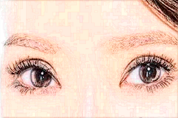 北大醫(yī)院割雙眼皮怎樣_哪個(gè)醫(yī)生做得好