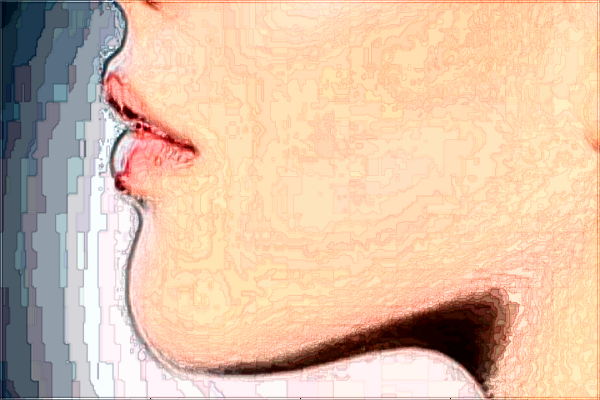 成都華西醫(yī)院墊下巴價目表(價格表)怎么樣