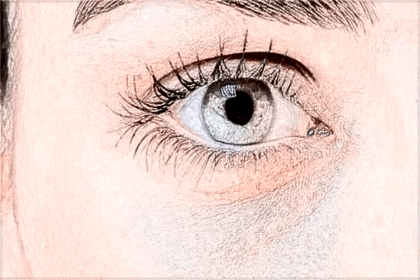 南昌大學(xué)第一附屬醫(yī)院去眼袋怎么樣?去眼袋恢復(fù)期是多久