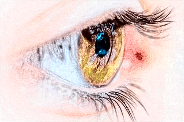 南昌大學(xué)第一附屬醫(yī)院雙眼皮怎樣?2024雙眼皮手術(shù)價格