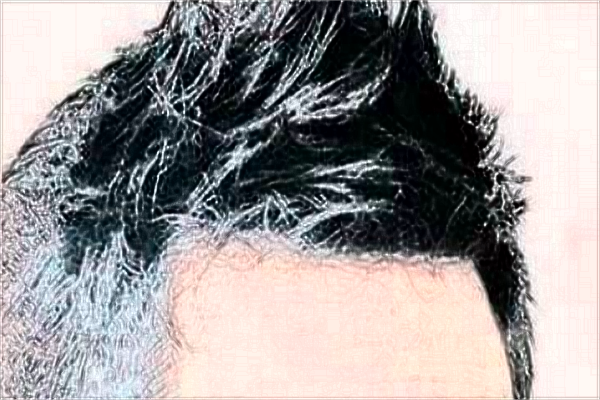 南昌大學(xué)第一附屬醫(yī)院種植頭發(fā)怎么樣?2024植發(fā)價格