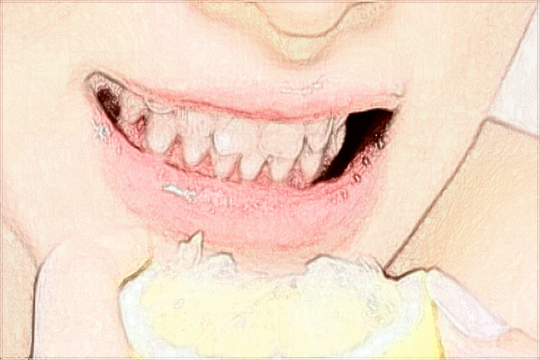 2024江蘇省口腔醫(yī)院牙齒美白做的好嗎_技術怎么樣