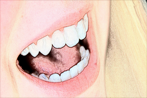 2024江蘇省口腔醫(yī)院牙齒美白做的好嗎_技術怎么樣