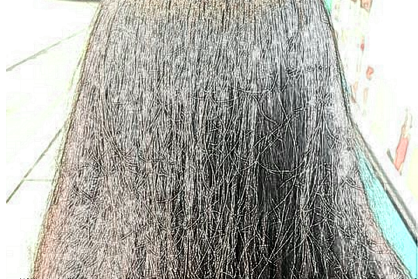 溫州醫(yī)學院附屬第一醫(yī)院種植頭發(fā)做的好嗎_哪位醫(yī)生做的好