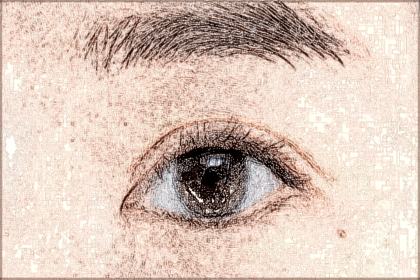 2024溫州醫(yī)學院附屬第一醫(yī)院做眼袋價目表(價格表)怎么樣