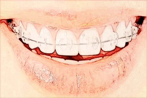 2024無錫市第二人民醫(yī)院口腔科哪個(gè)醫(yī)生好_價(jià)格貴不貴