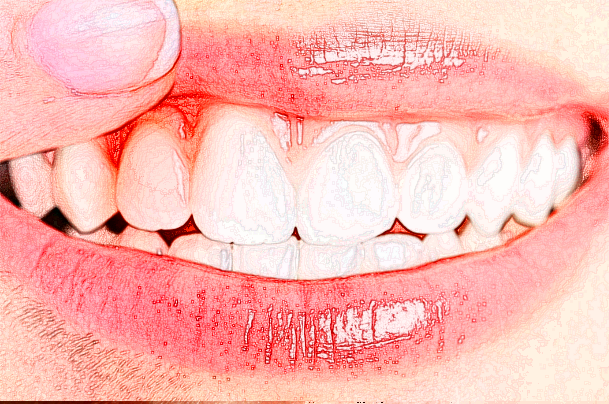 寧波市第一醫(yī)院補(bǔ)牙哪位醫(yī)生做的比較好_需要多少錢