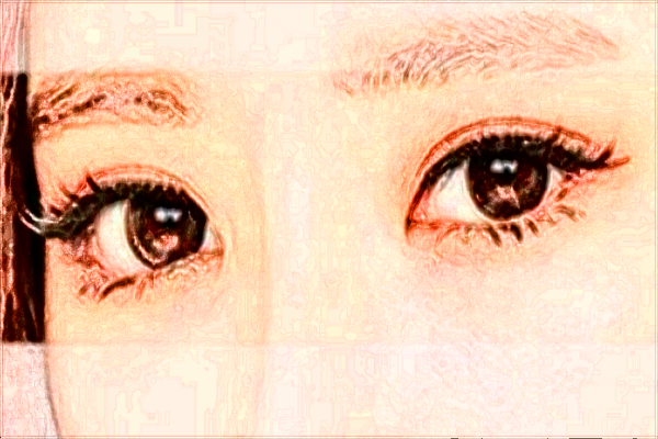 2024四川華西醫(yī)院割雙眼皮價(jià)格多少_做的怎么樣