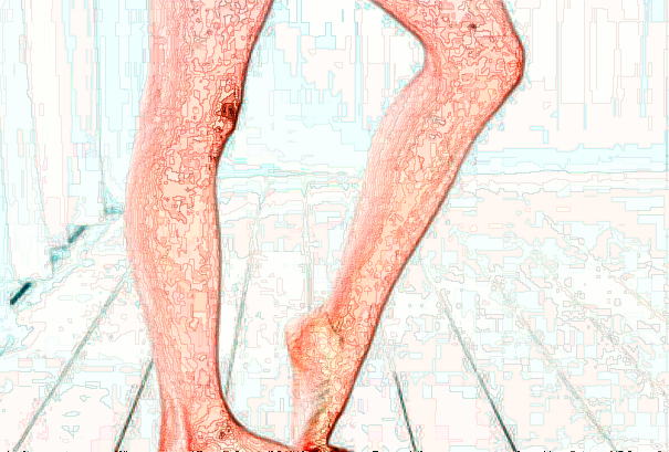 北京大學第一醫(yī)院洗紋身價目表(價格表)怎么樣